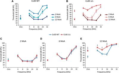 Connexin 30 deletion exacerbates cochlear senescence and age-related hearing loss